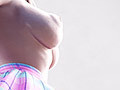 sides
