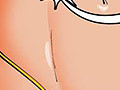 comix